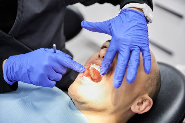 Best Emergency Wisdom Teeth Removal in Sallisaw, OK