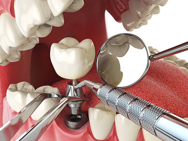 Best Emergency Root Canal Treatment in Sallisaw, OK